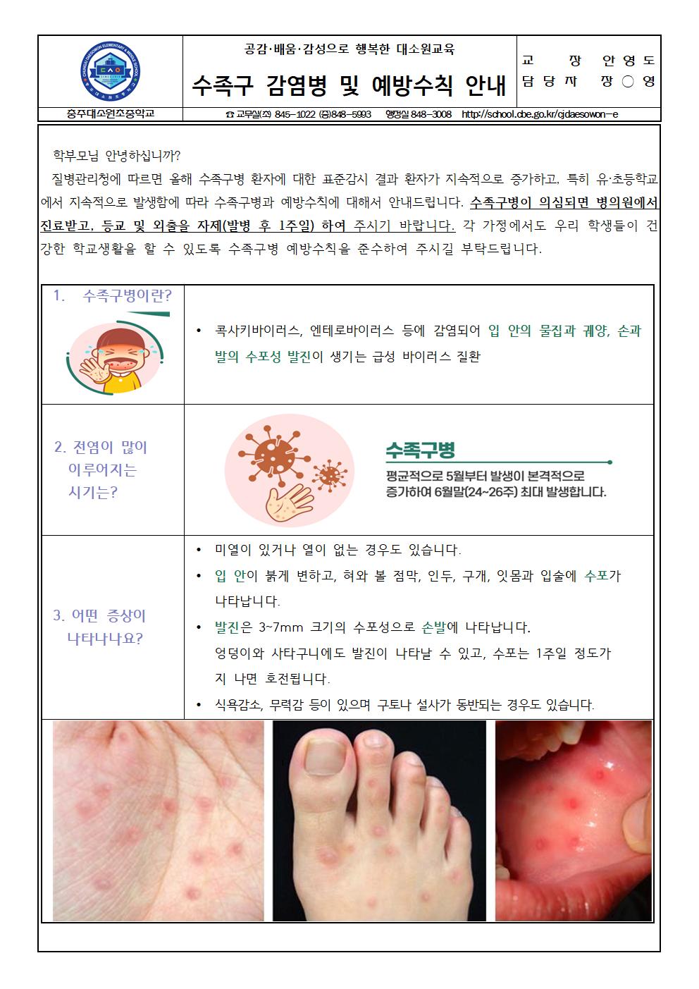 수족구 감염병 및 예방수칙 안내 가정통신문001