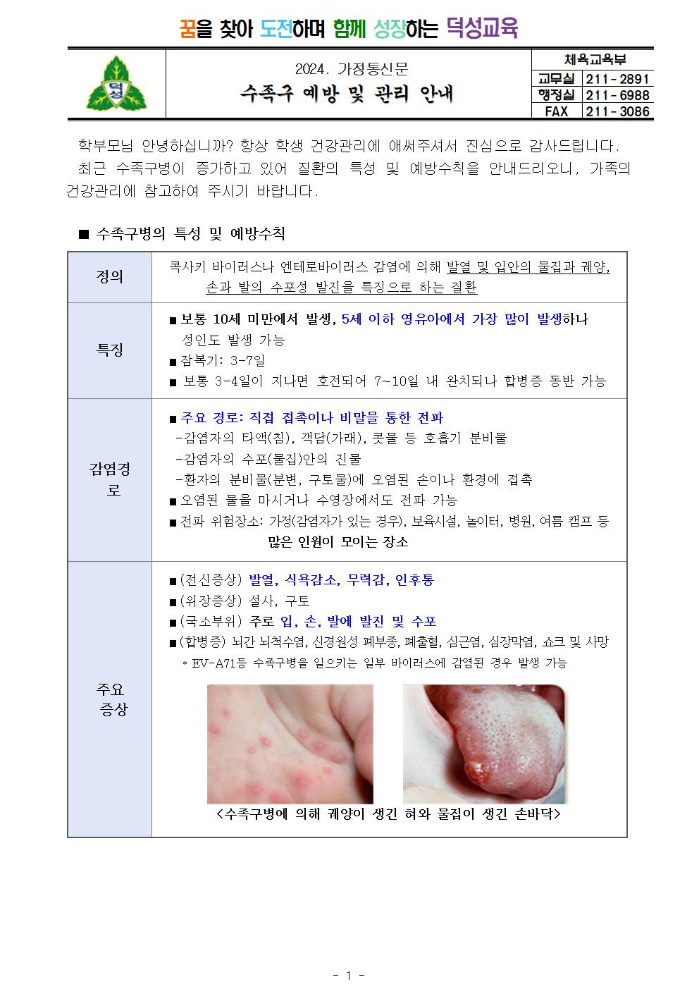 수족구 예방 및 관리 안내001