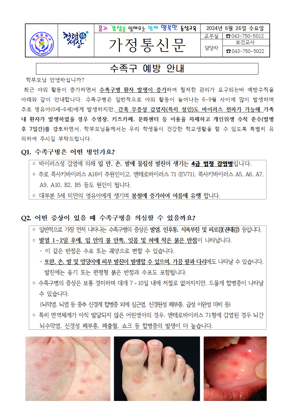 9. 수족구 예방 안내001001