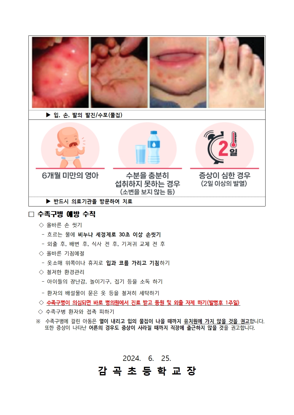 수족구 예방 안내 가정통신문002