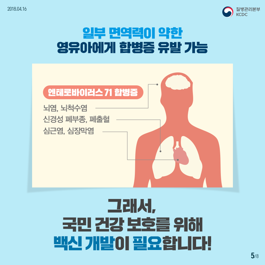 사본 -180416_수족구병_04속지_v2