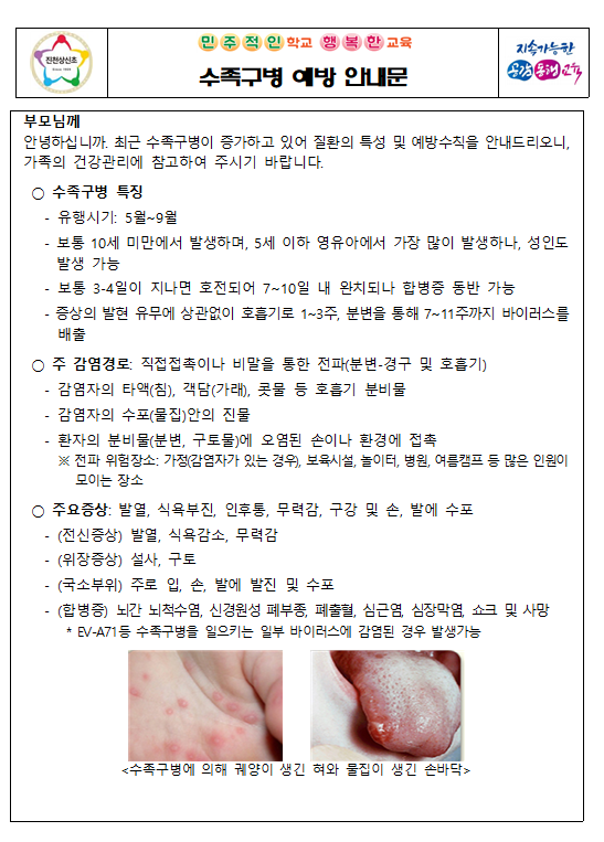 수족구1