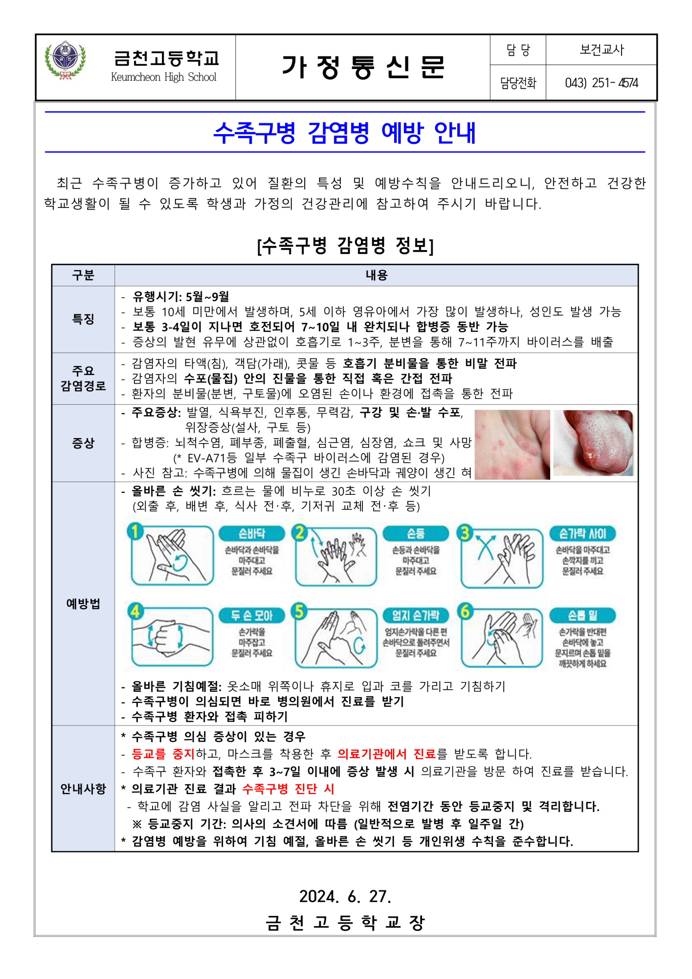 수족구병 감염병 안내_1