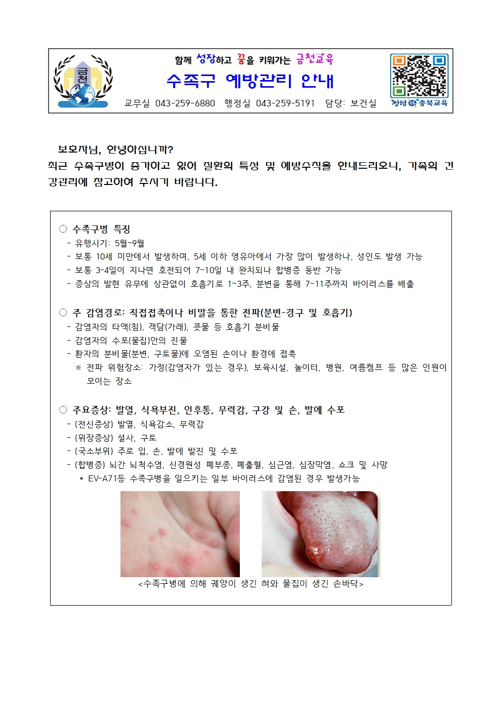 수족구 예방관리 안내001