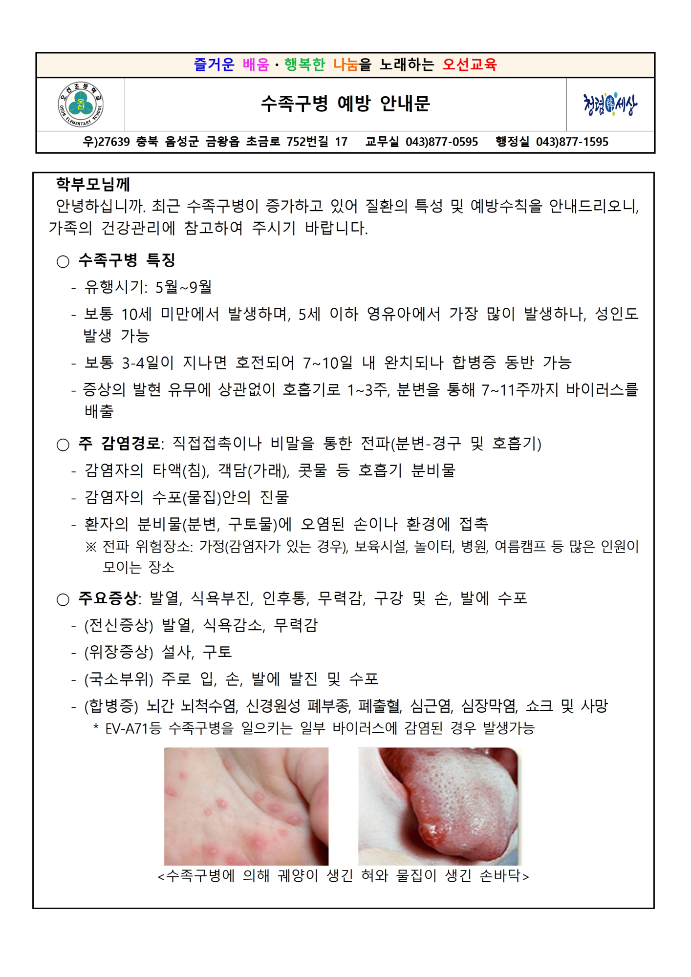 수족구병 예방 안내문001