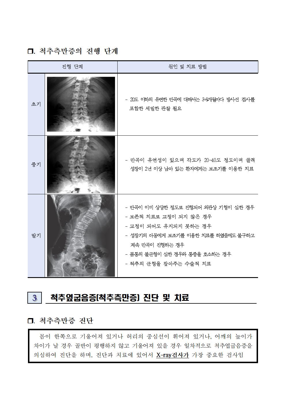 척추옆굽음증 검사 사전교육자료003