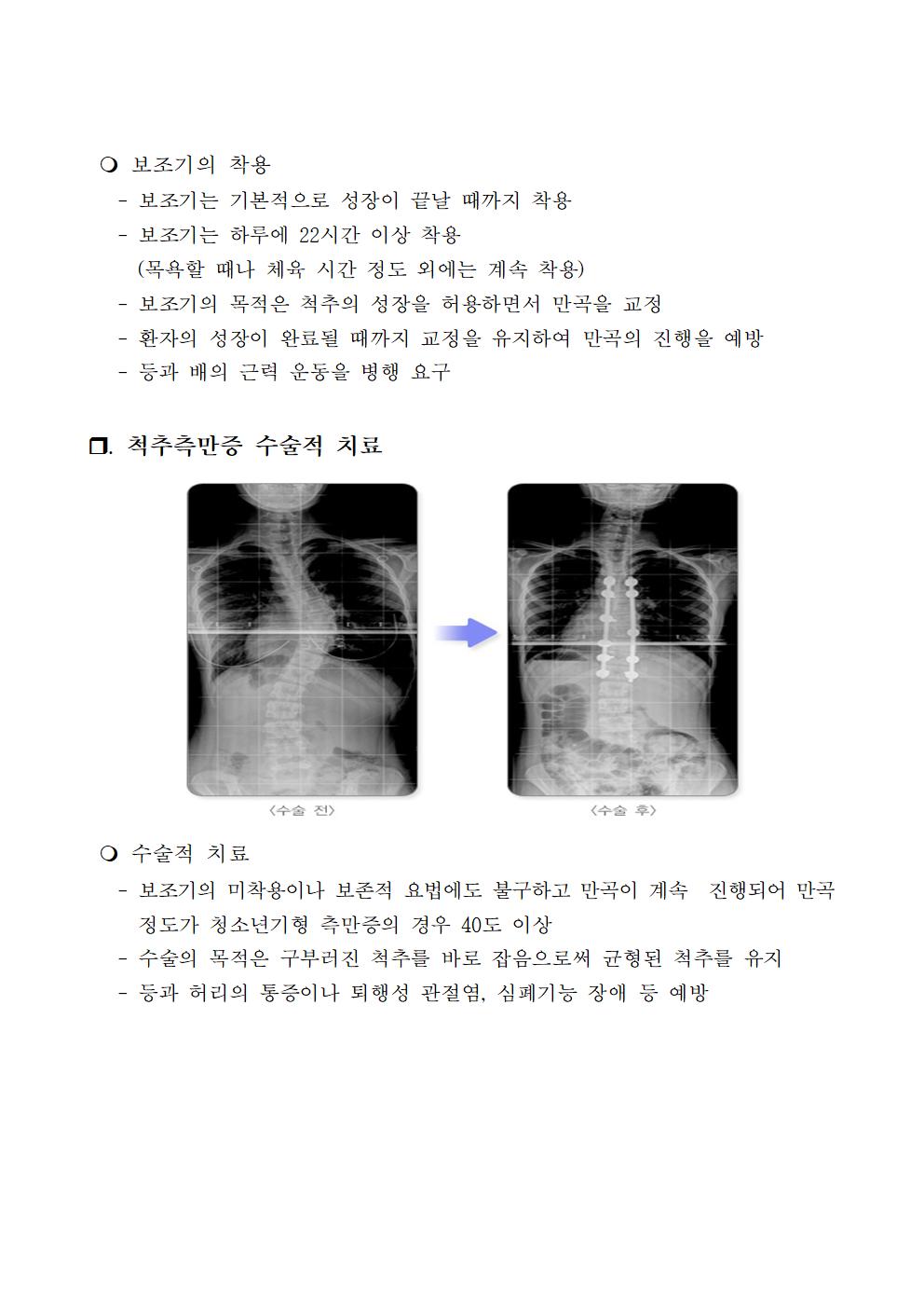 척추옆굽음증 검사 사전교육자료005