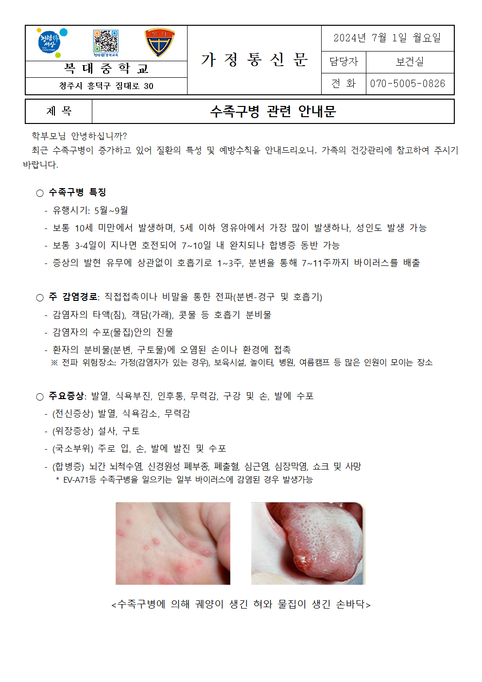 수족구병 관련 안내문001