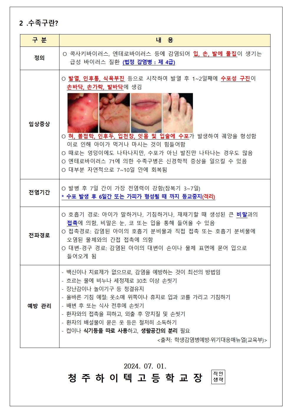 2024. 수두 및 수족구병 예방 안내문002