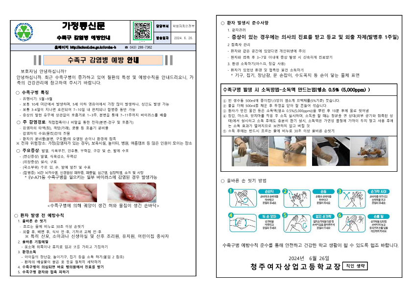 수족구 감염병 예방 안내_1