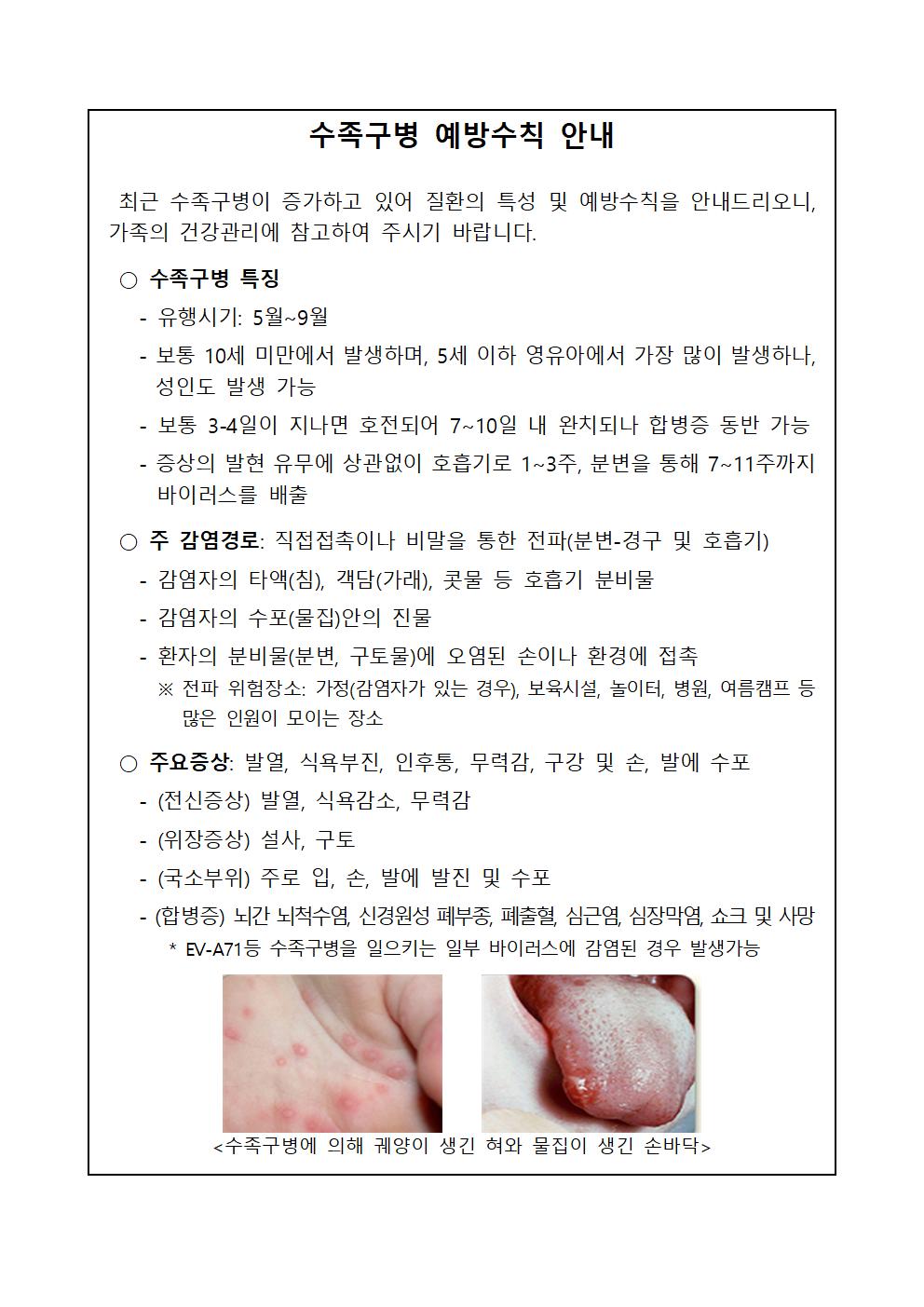 수족구병 예방수칙 안내문001