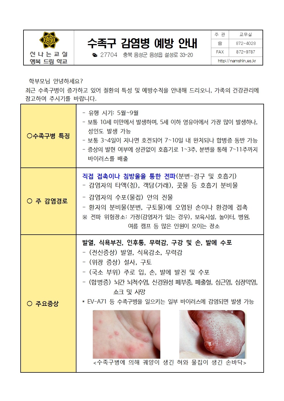 수족구병 감염병 예방관리 안내 가정통신문001