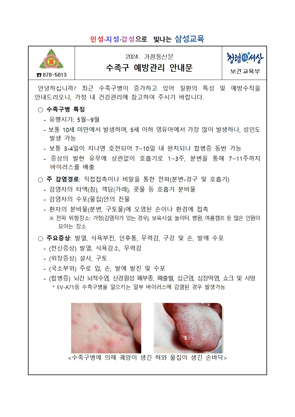 수족구 예방관리 안내문(삼성초)001