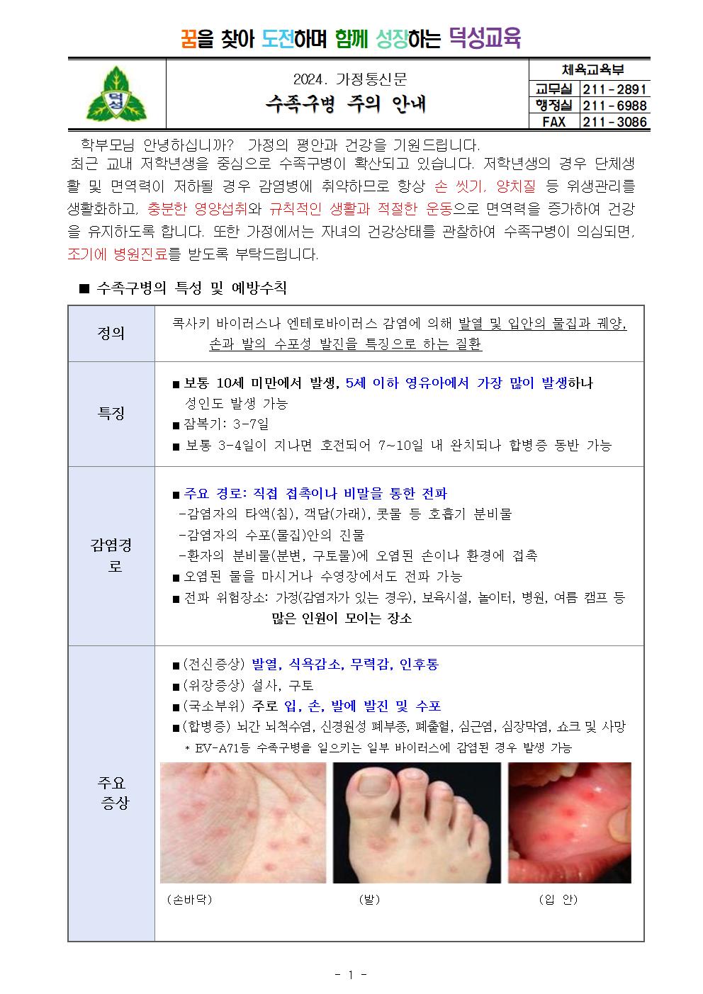 수족구병 주의 안내001