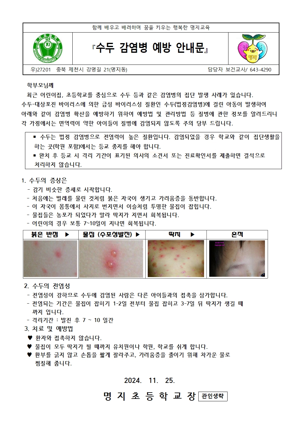 수두 감염병 예방 안내 001