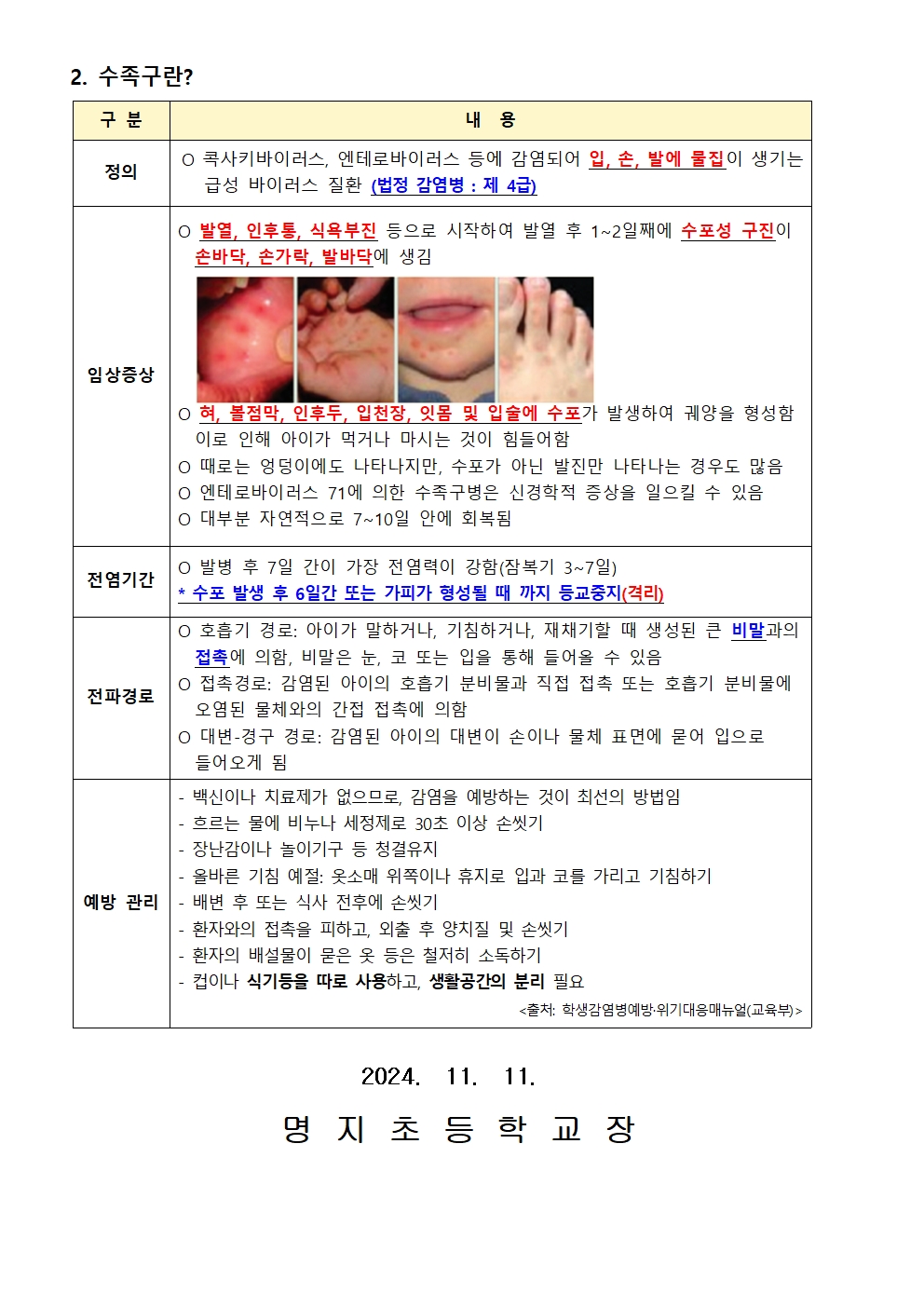 수두 및 수족구병 예방 안내002