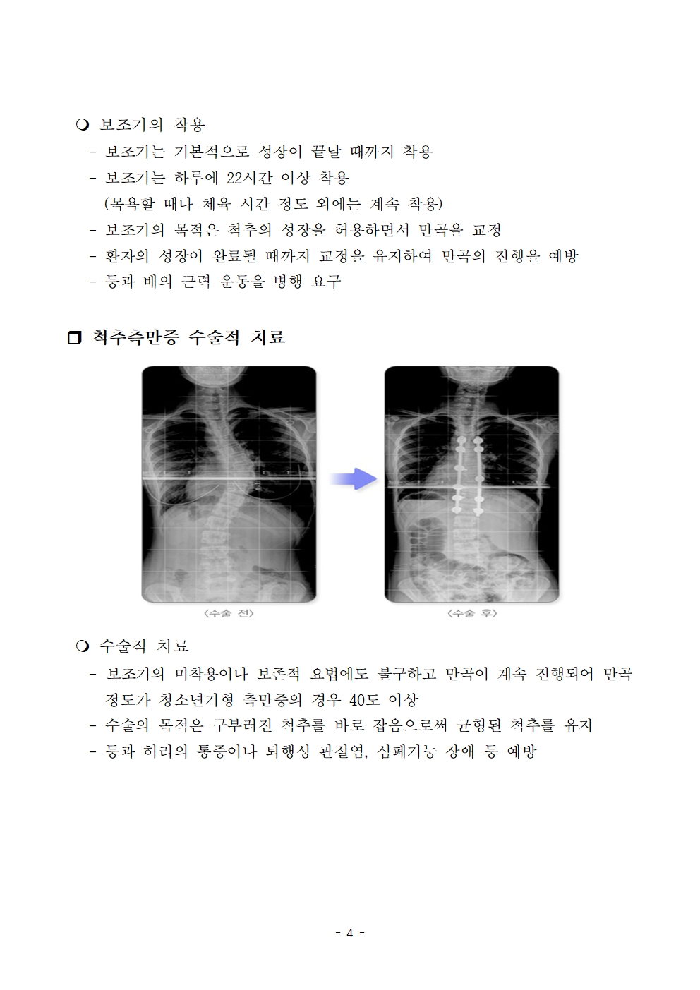 척추옆굽음증 검사 사전교육자료004