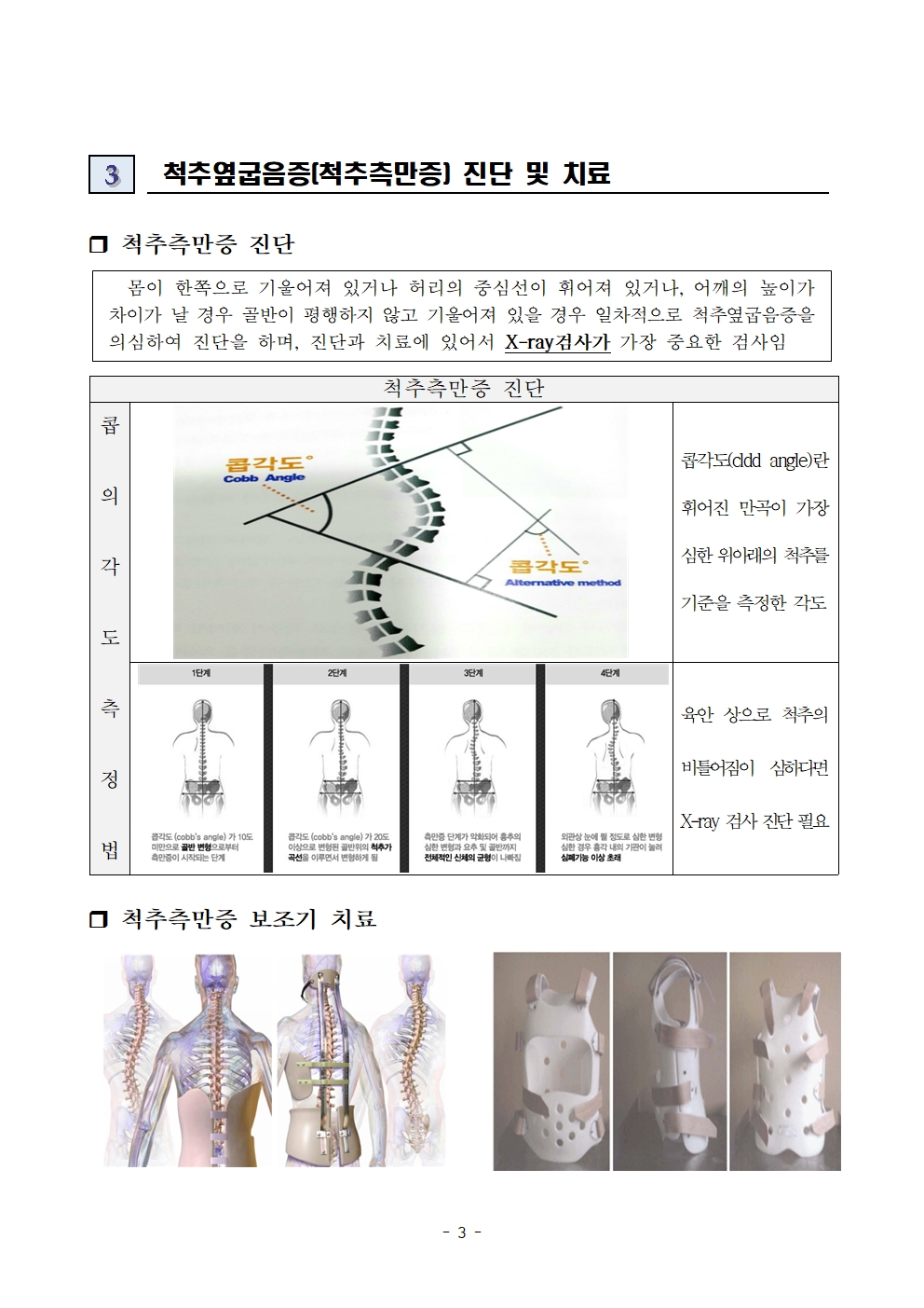 척추옆굽음증 검사 사전교육자료003