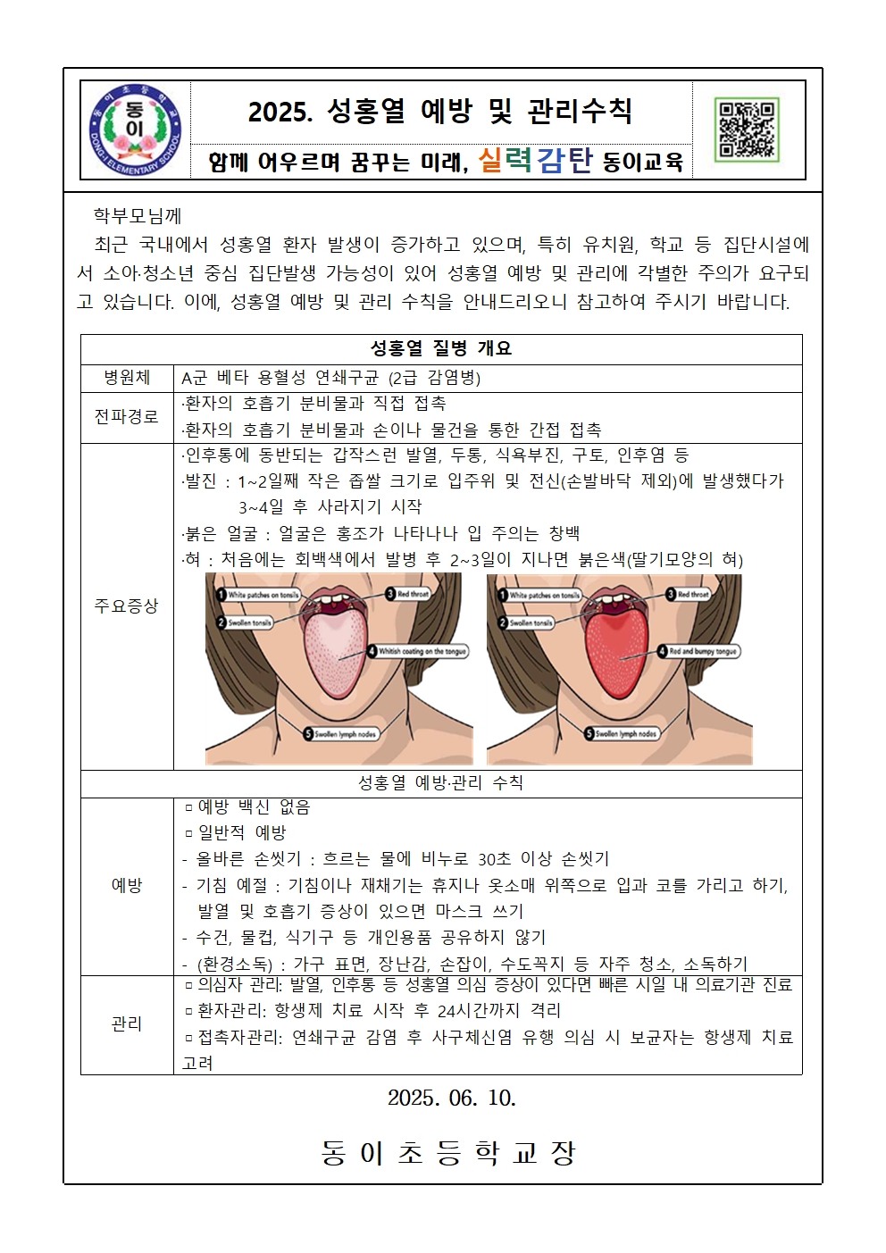 성홍열 예방 및 관리 수칙 안내001