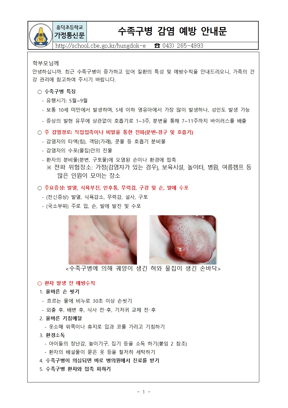 수족구병 감염 예방 안내문001