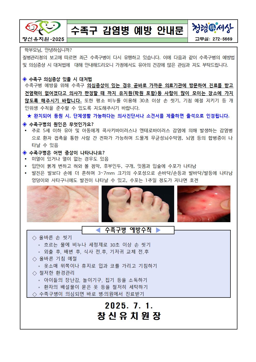 수족구 감염병 예방 안내문001