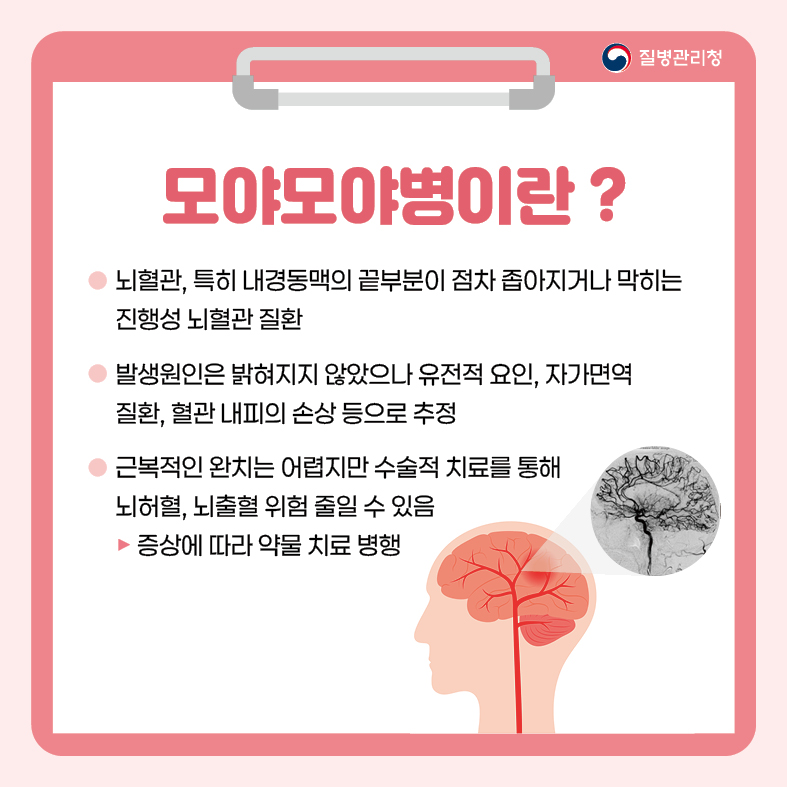 카드뉴스-모야모야병-최종