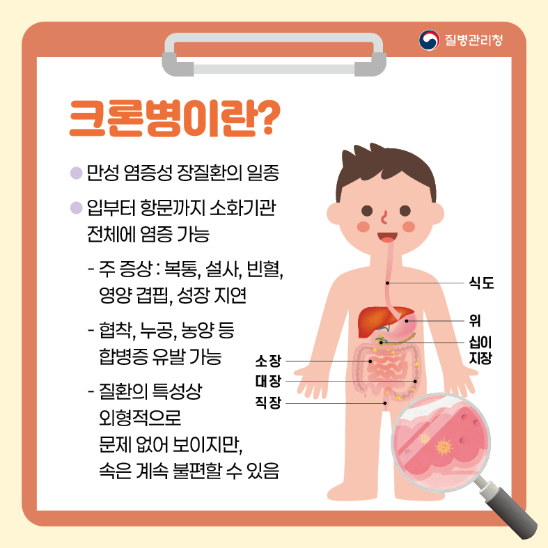 카드뉴스-크론병
