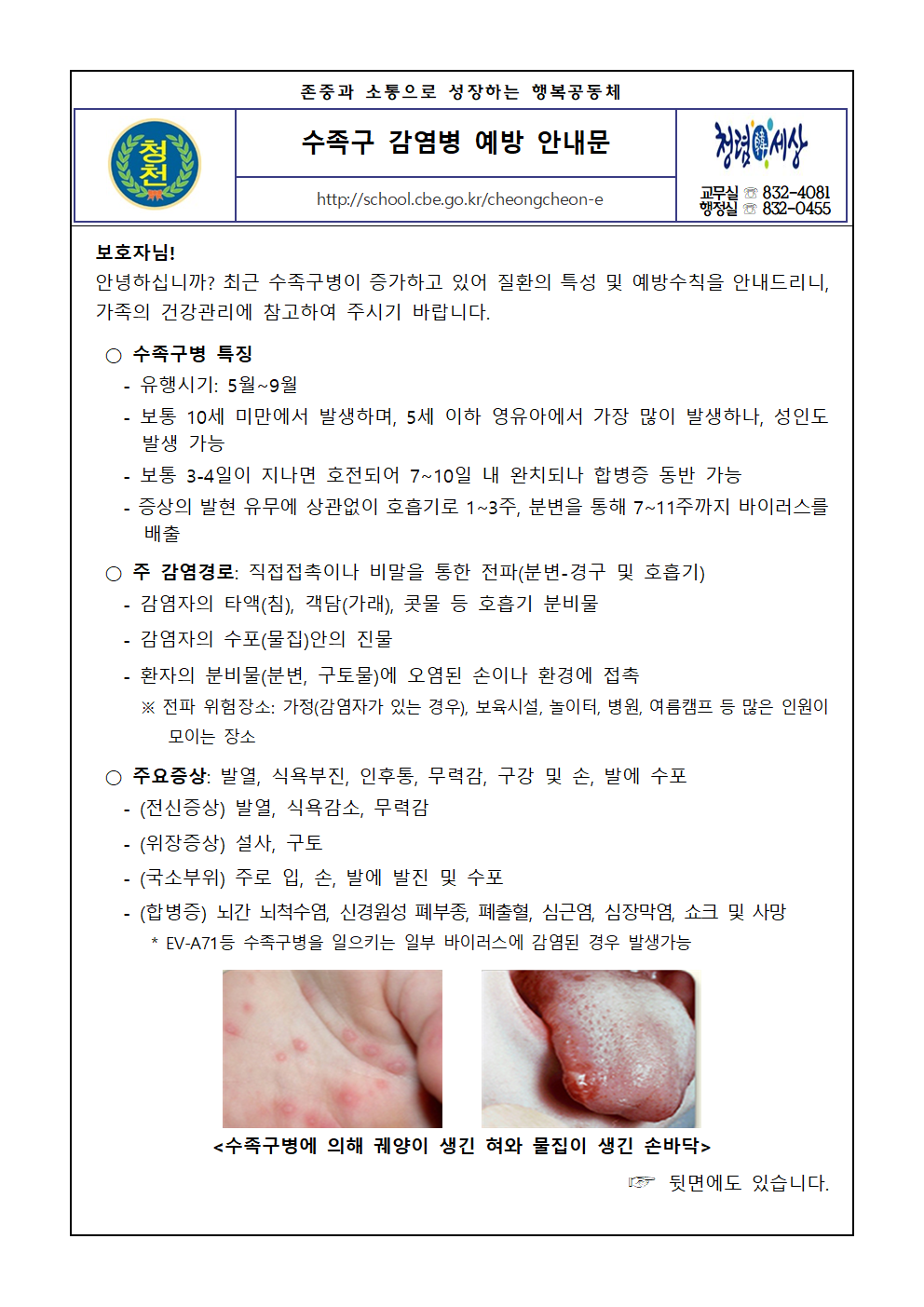 2025. 수족구 예방 안내 가정통신문(청천초)001