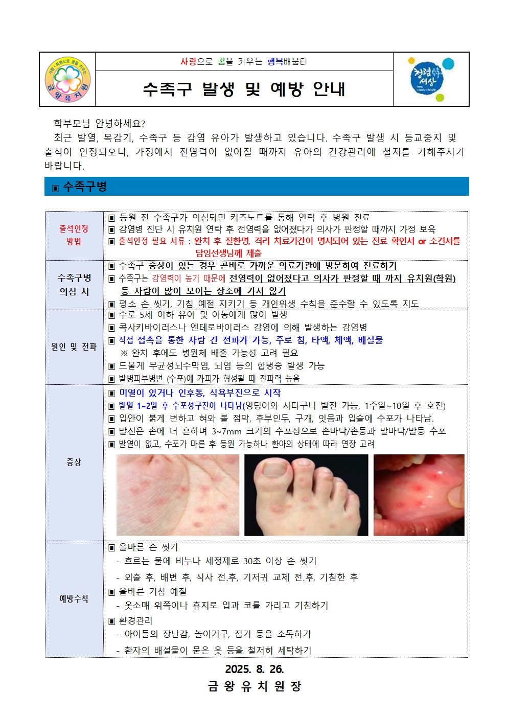수족구병 발생 및 예방 안내001