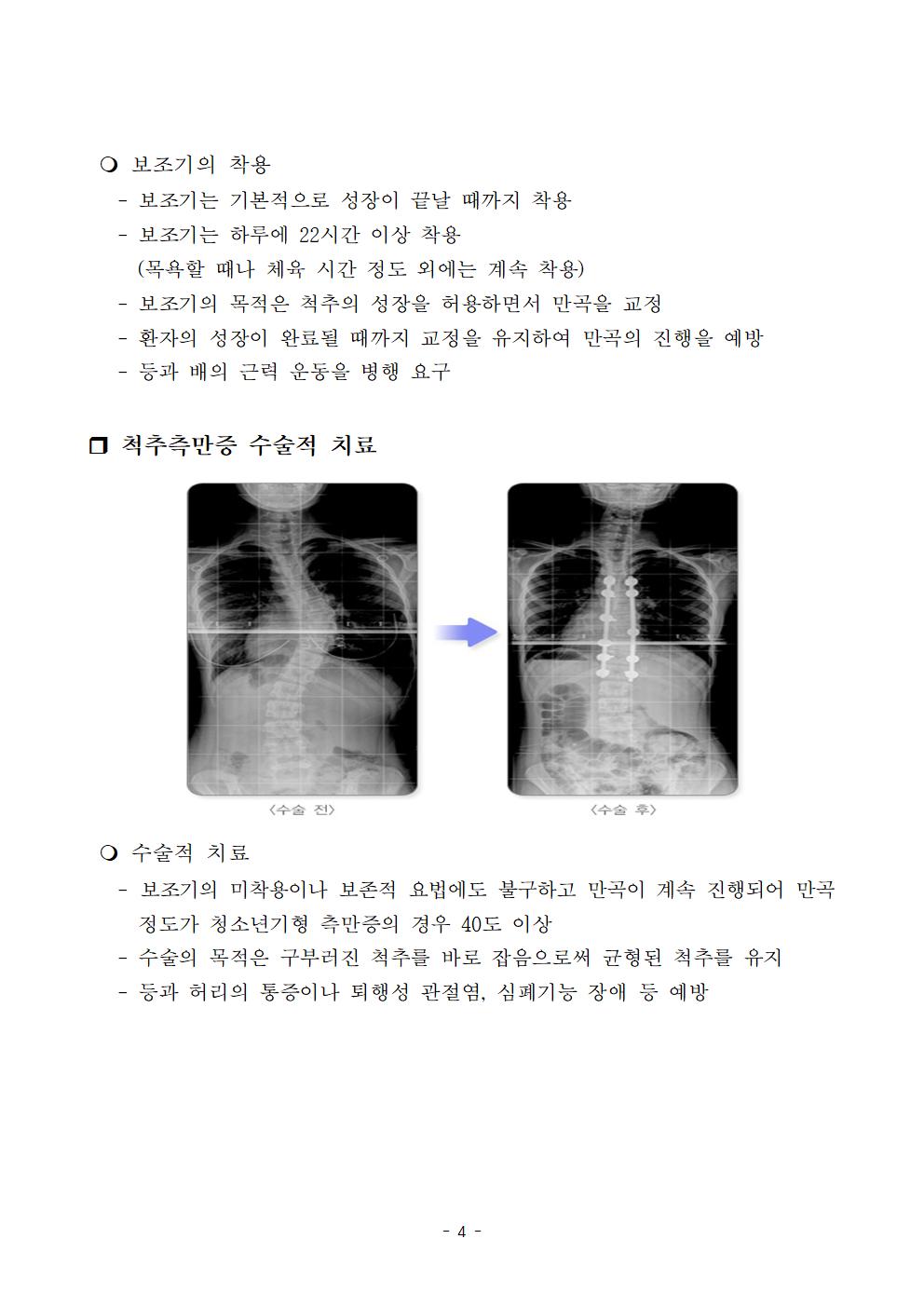 척추옆굽음증 검사 사전교육자료004
