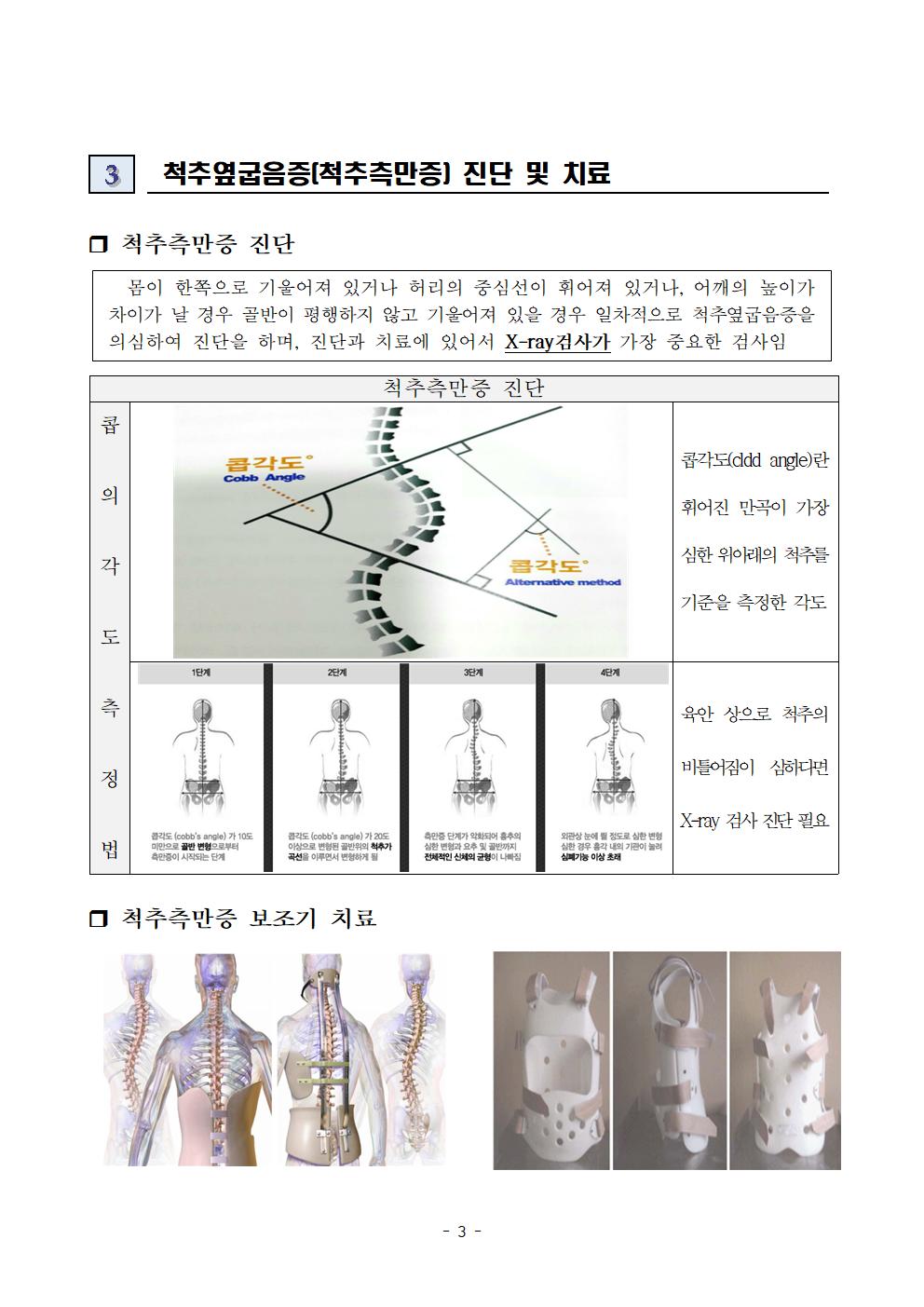척추옆굽음증 검사 사전교육자료003